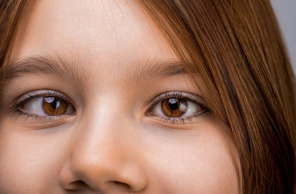 Close-up of a young person with eyes slightly misaligned