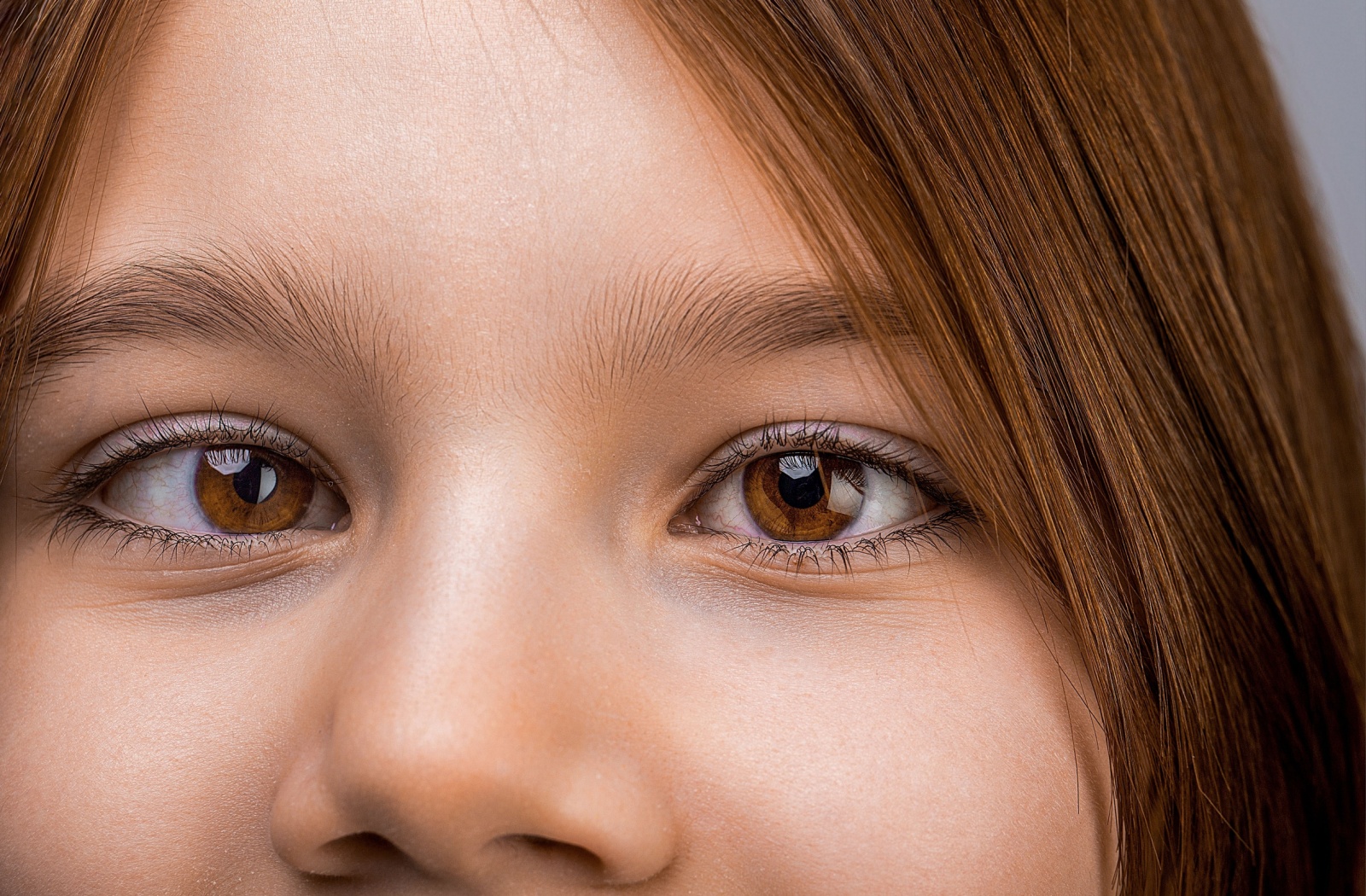 Close-up of a young person with eyes slightly misaligned