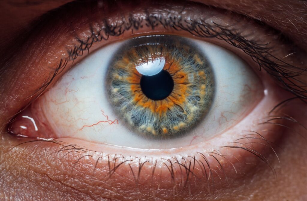 A close up of an eye where you can see the tiny red blood vessels.